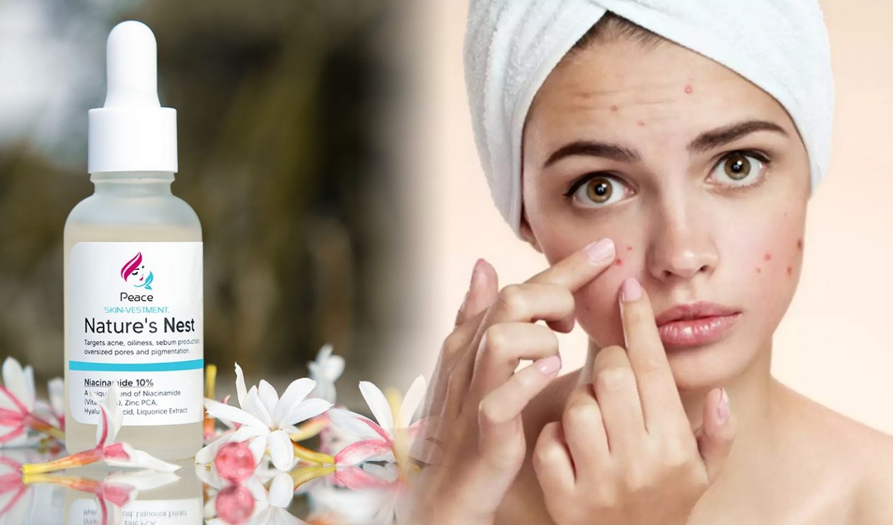  Acne Face – The Number 1 Secret I Used To Clear My Acne