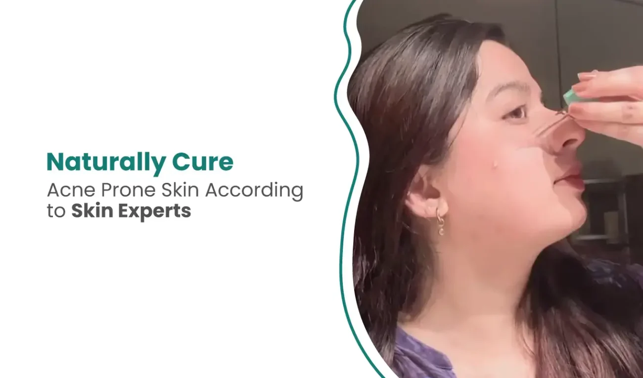 How to Naturally Cure Acne Prone Skin According to Skin Experts in 2024